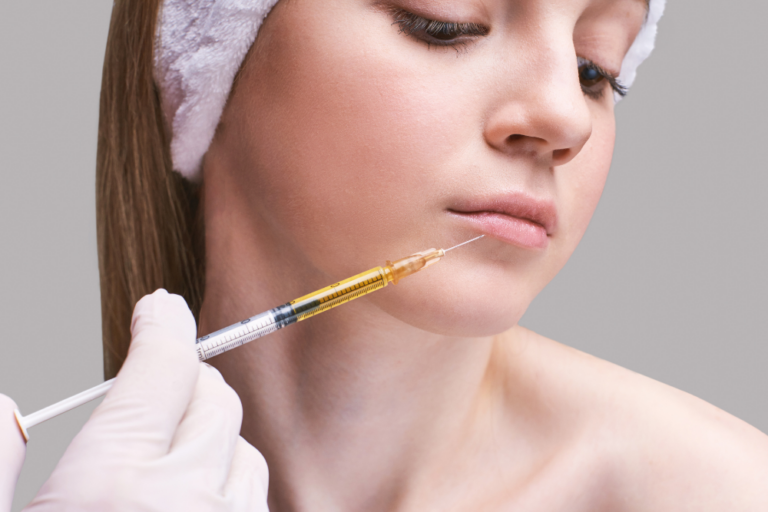 #1 Lip Filler Injections Near Tysons Corner