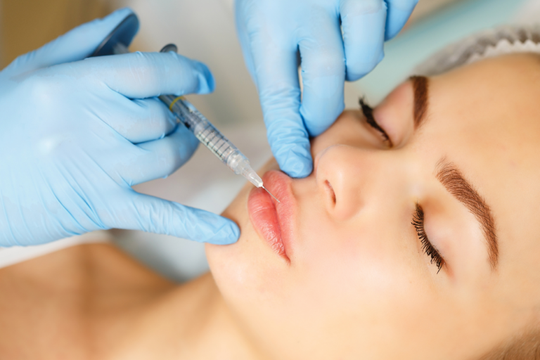 Lip Filler 101: Everything You Need to Know Before Your Arlington Appointment