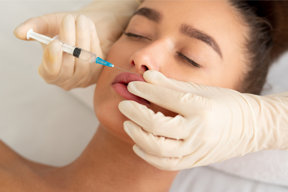 How Alexandria Residents Are Achieving Fuller Lips with Expert Filler Injections