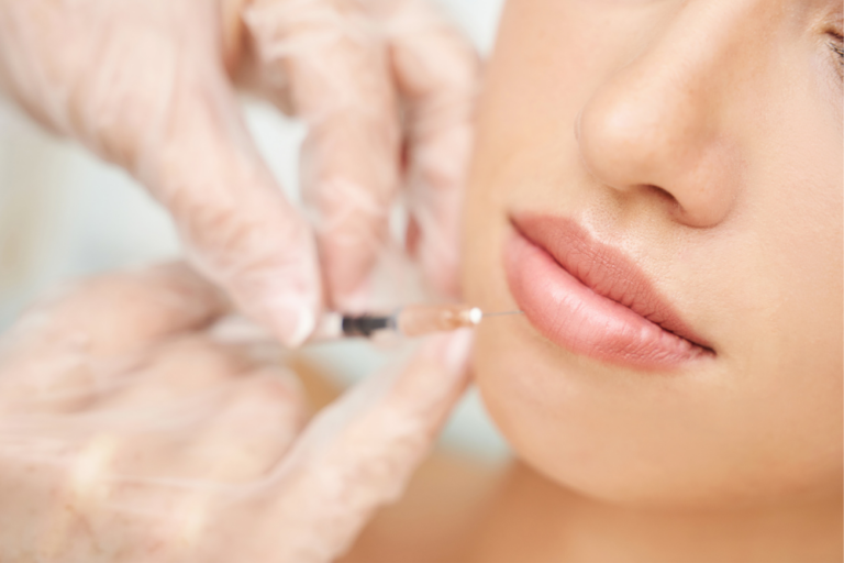 How to Find Trusted Specialists in McLean Offering Personalized Lip Filler Treatments