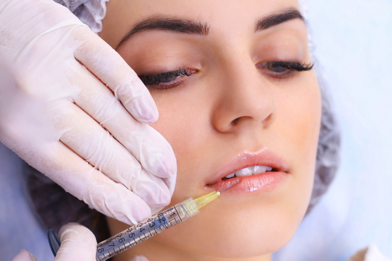 Comprehensive Lip Filler Services for Smooth Natural-Looking Lips in Chantilly